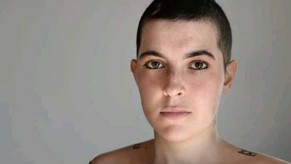 Tumore incurabile, Camilla Zago muore a soli 25 anni