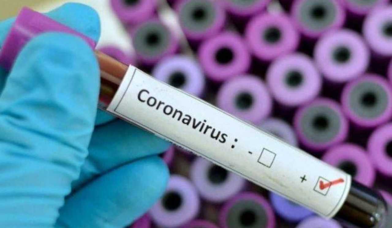 sospetto coronavirus italiana cile