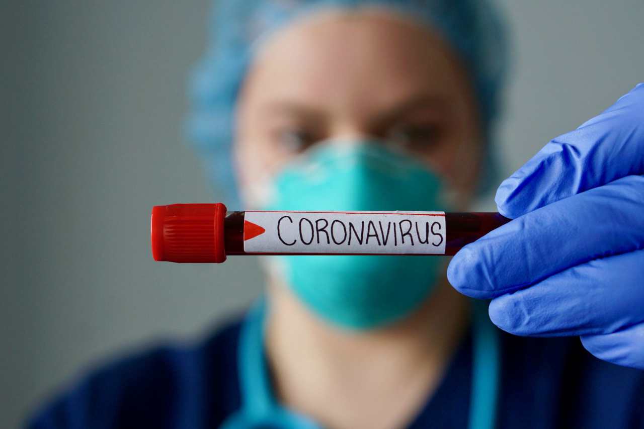 CORONAVIRUS E SARS A CONFRONTO