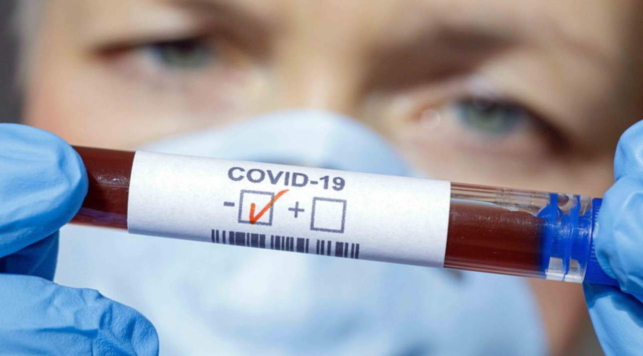 ue coronavirus europa impari dall'italia