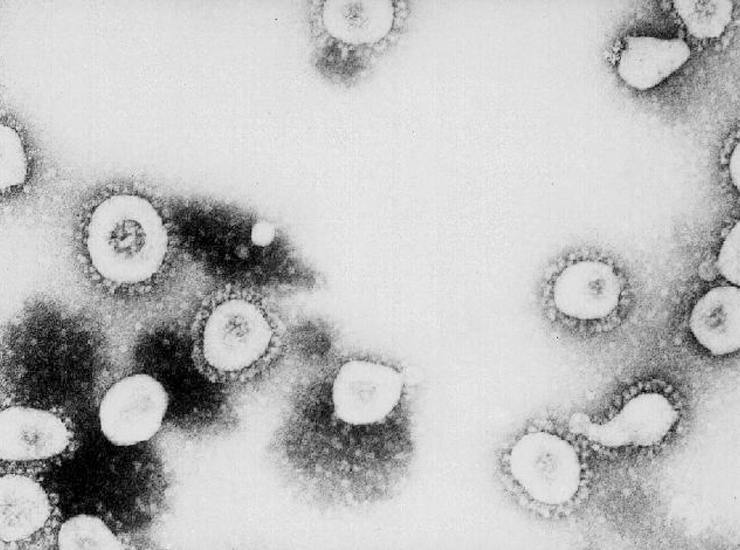 Coronavirus 