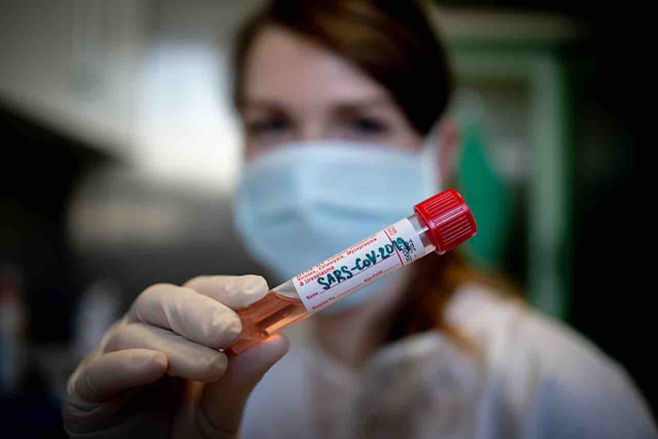 Il Coronavirus non è stato creato in laboratorio, la prova in uno studio pubblicato su Nature Medicine (Getty) - meteoweek.com