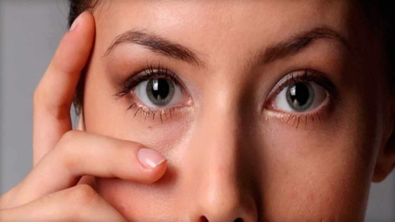 Темные круги под глазами женщин лечение