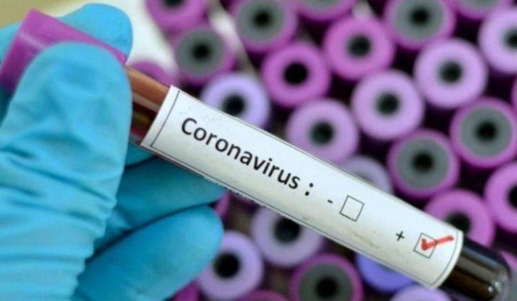 coronavirus - provetta