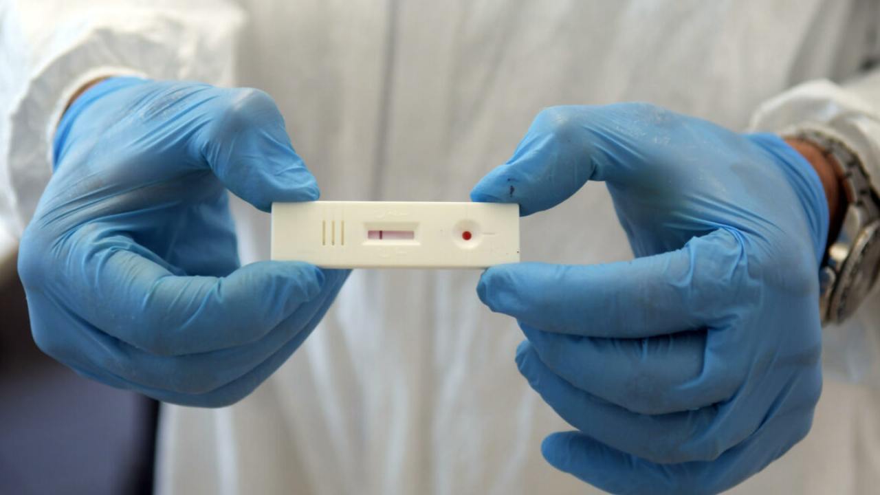 coronavirus test sierologici