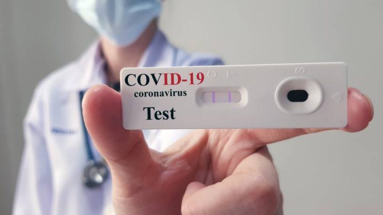 test sierologici coronavirus