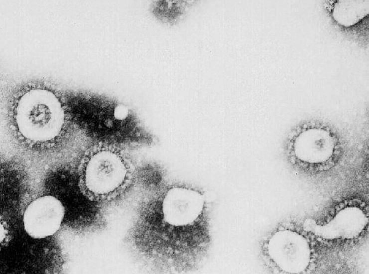 Coronavirus, un gene difettoso farebbe crescere il rischio di contrarlo (Gettyimages)