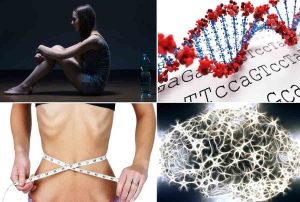 Anoressia gene
