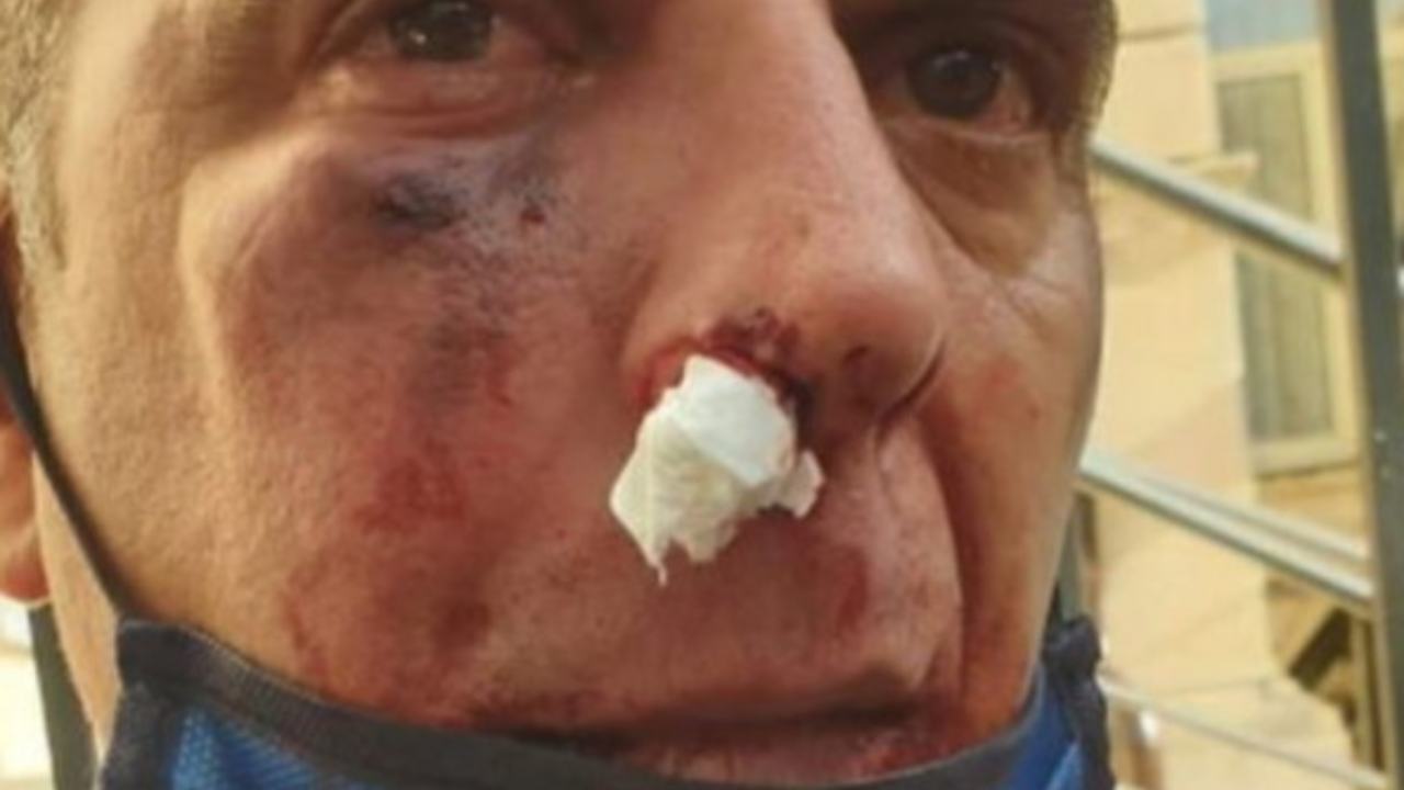 Immigrato prende a pugni carabiniere spaccandogli la faccia