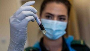 Stop ai test sull'anticorpo Lilly per pazienti gravi