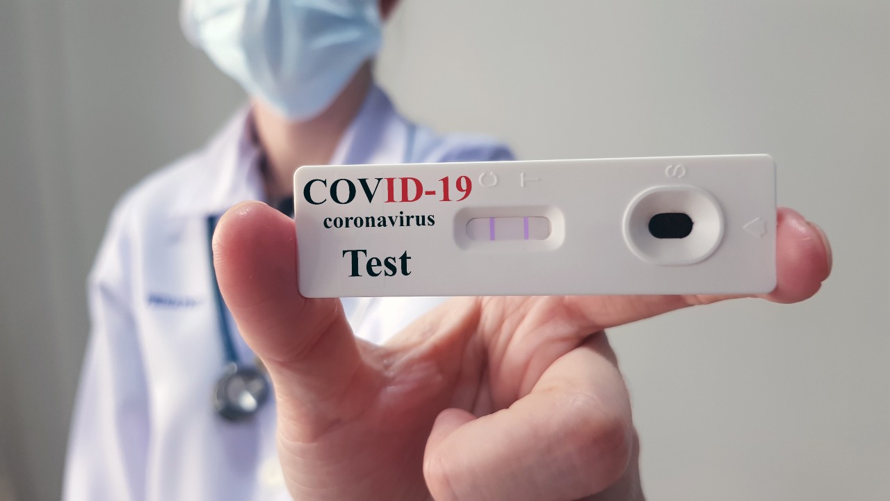 Covid, i test rapidi arrivano nelle farmacie e dai medici di base: i costi Covid, i test rapidi arrivano nelle farmacie e dai medici di base: i costi
