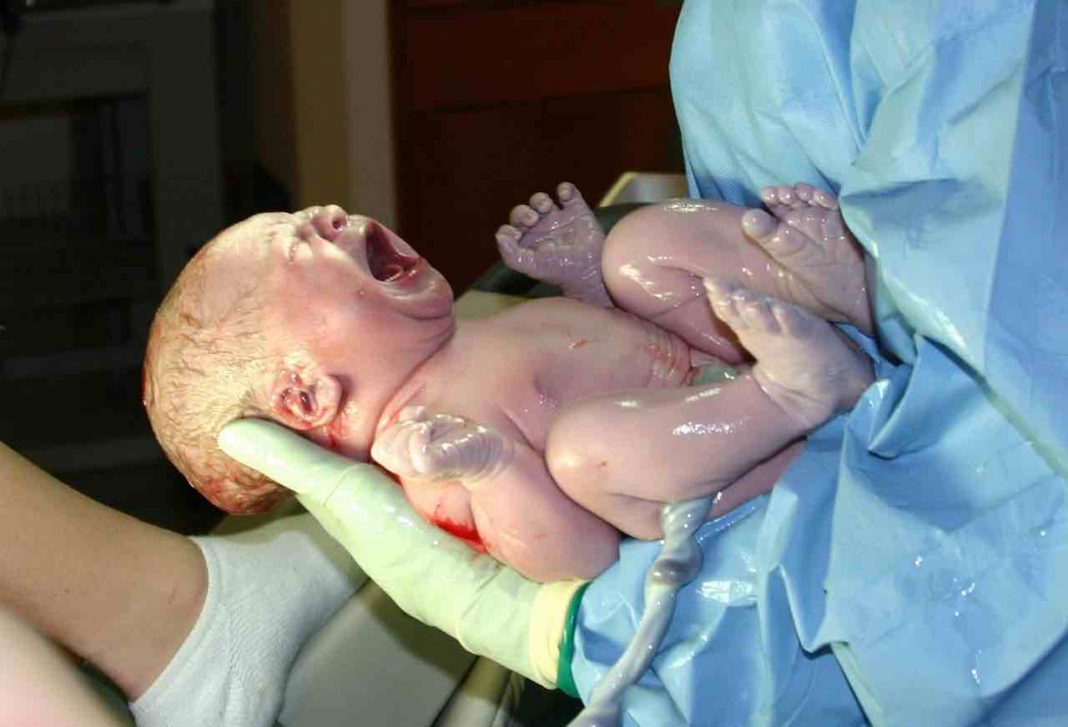 Sindrome Di Moschowitz Si Muore
