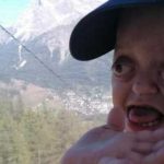 Addio a Tobia, bimbo che lottò contro la sindrome di Crouzon: aveva 4 anni Addio a Tobia, bimbo che lottò contro la sindrome di Crouzon: aveva 4 anni