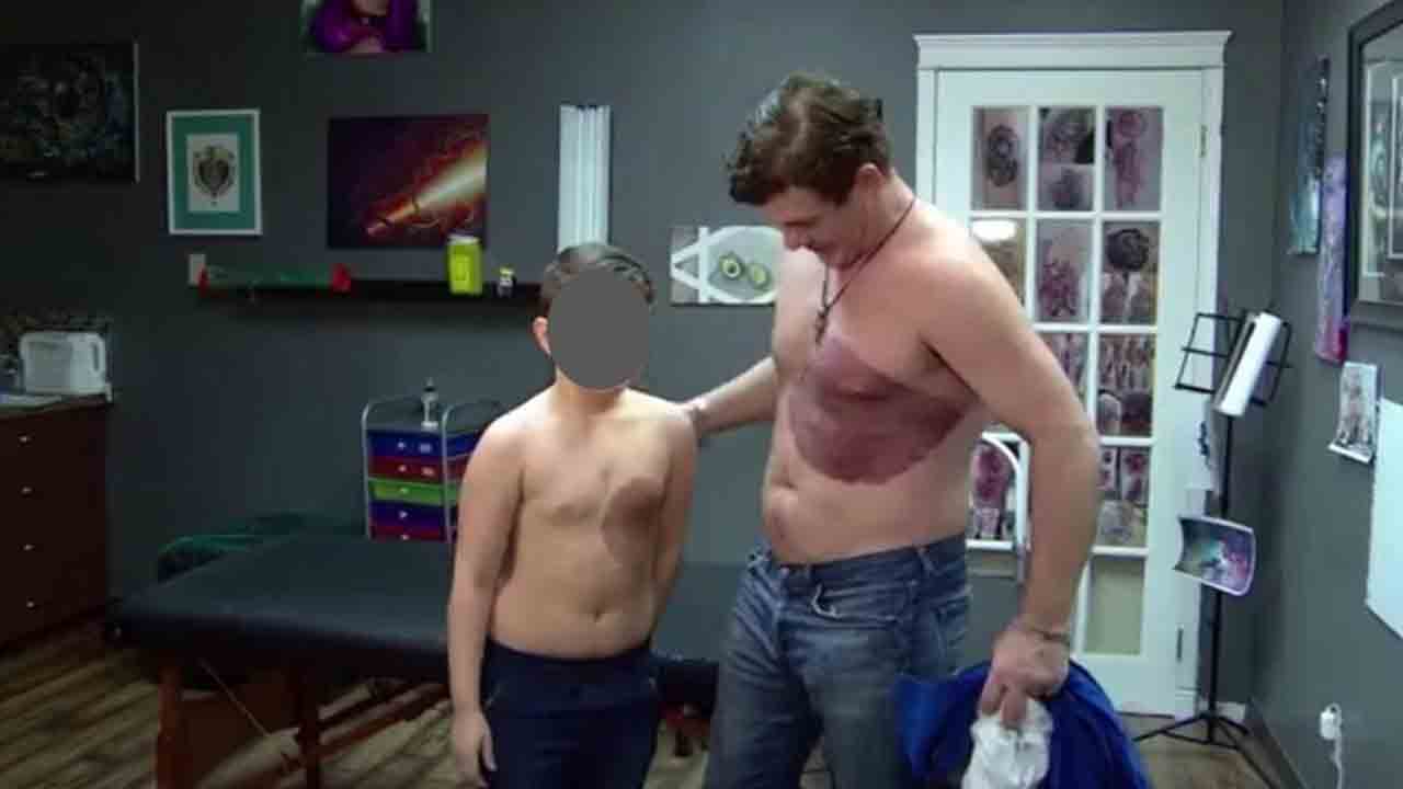 Bambino di 8 anni con una voglia sul torso e suo padre