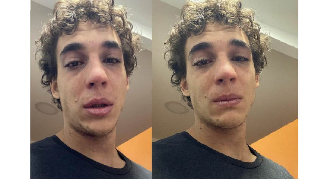 Miguel Herrán in lacrime su Instagram: “non voglio parlare né mangiare”