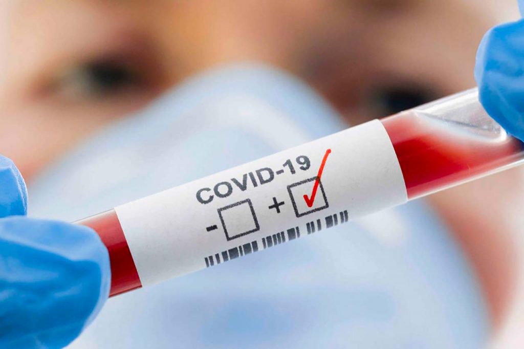 Varianti Covid, l’Europa: almeno 500 test alla settimana per tracciarle