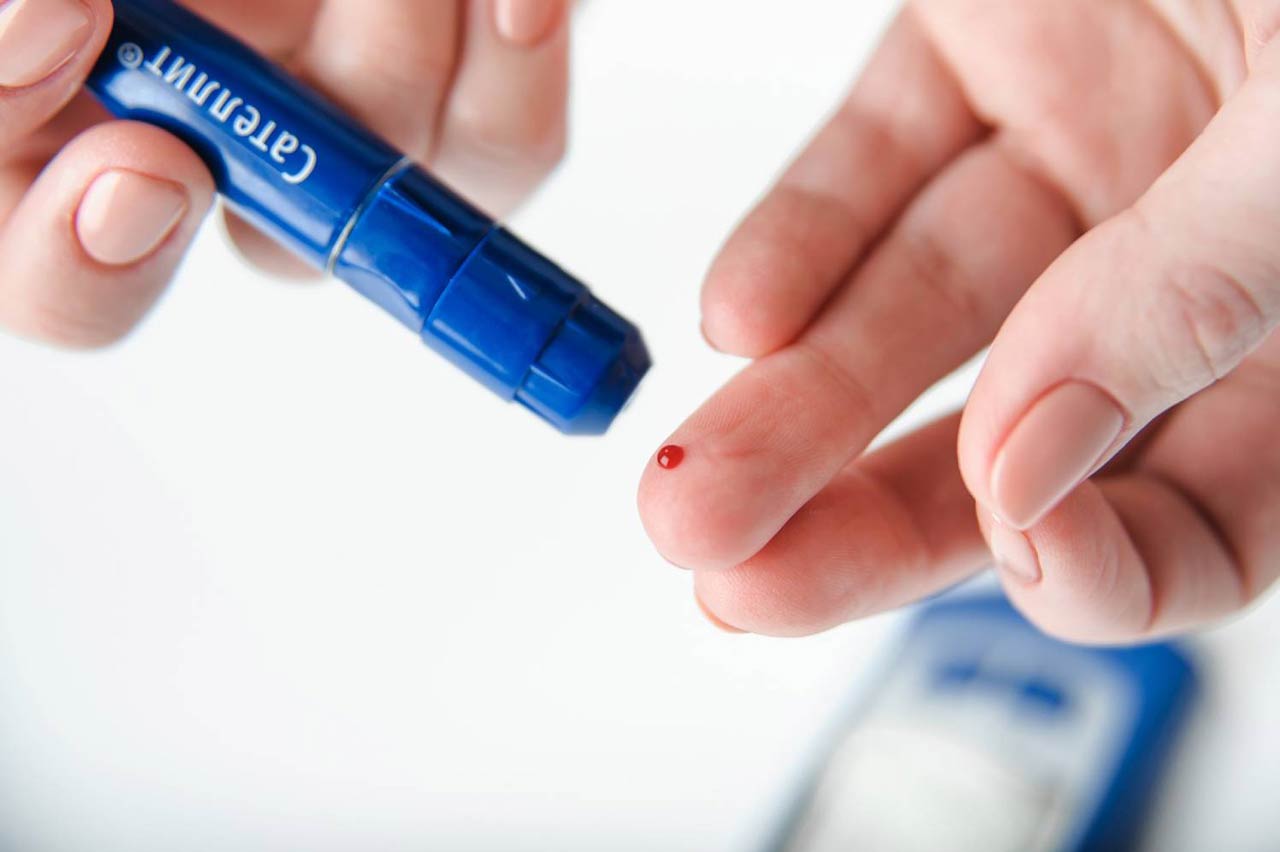 Diabete indotto dal Covid, è allarme dopo 350 casi clinici