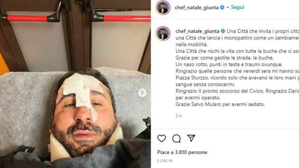 Incidente in monopattino per lo chef Natale Giunta: l’immagine choc sui social