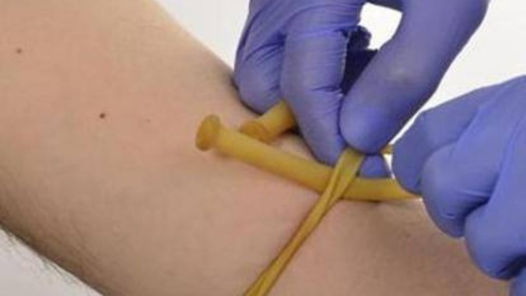 Cerca di bloccare il vaccino col laccio emostatico: operato no vax