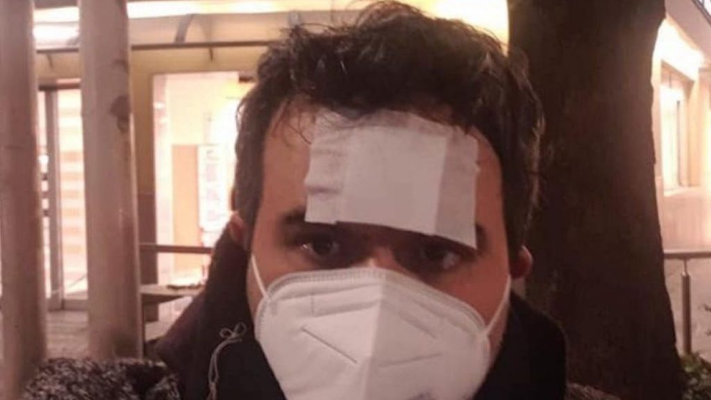 Professore picchiato a Napoli: tra gli aggressori anche genitori degli alunni